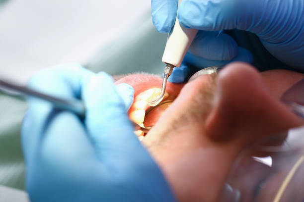 Trusted VA Emergency Dentist Experts